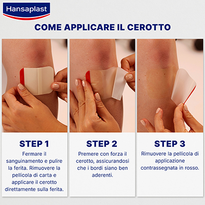 visual-cerotti-idrocolloidali-applicazione